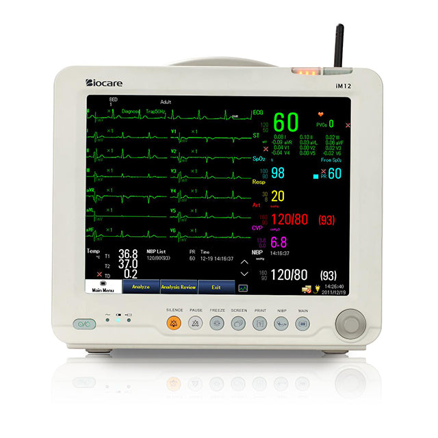 A Biocare veterinary multi-parameter monitor with a color TFT screen displaying heart rate data, among other readings, in a hospital setting.